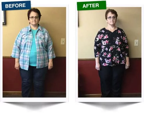 Weight Loss Rochester NY Weight Loss Testimonial - Stacy