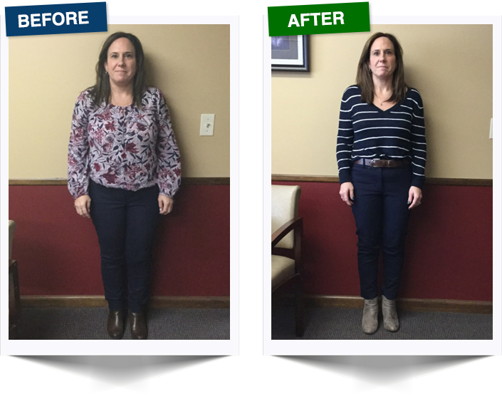 Weight Loss West Rochester NY Patient Testimonial