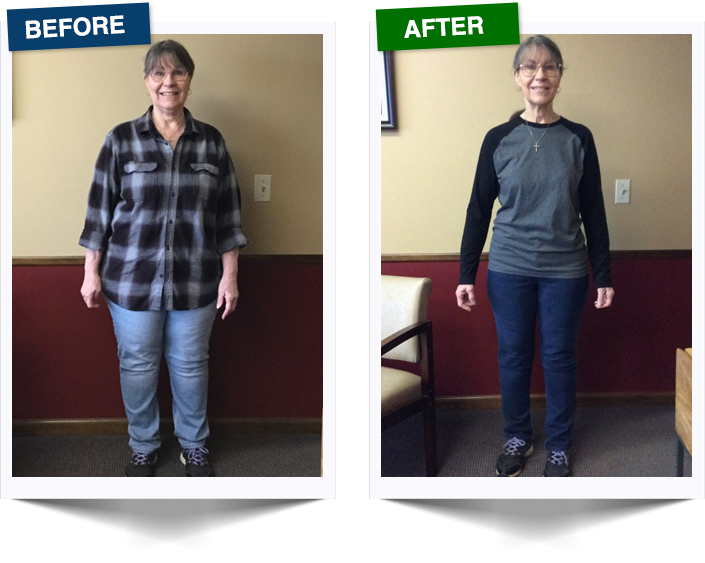 Weight Loss Gates NY Patient Testimonial